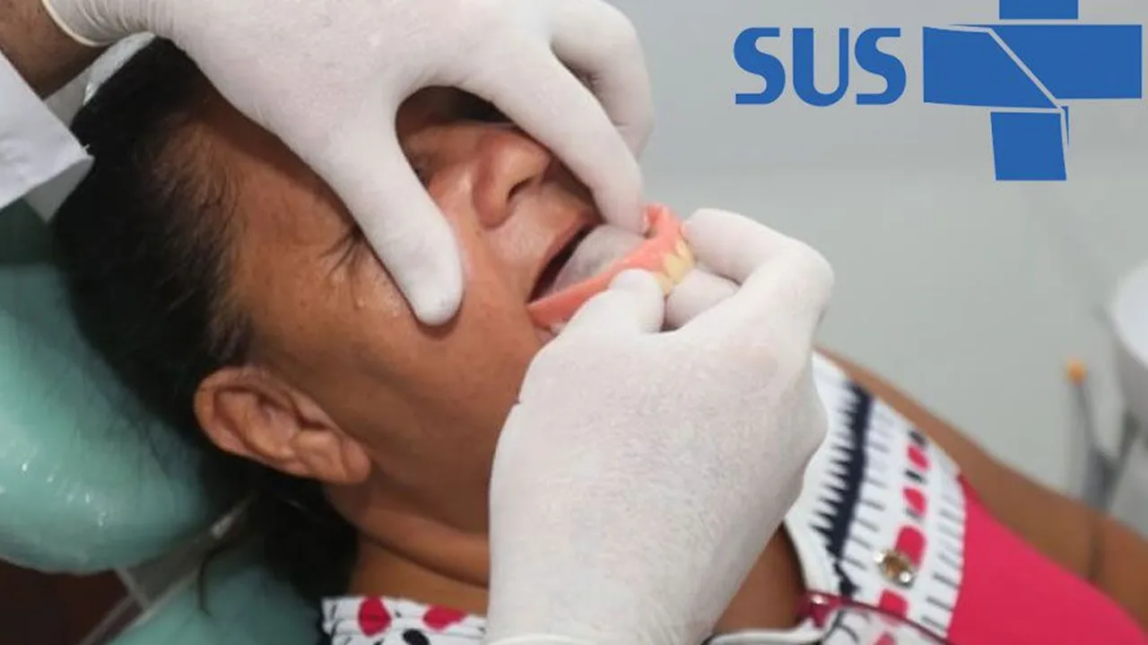 implante dent rio gratuito pelo sus descubra como agora 989d0e56